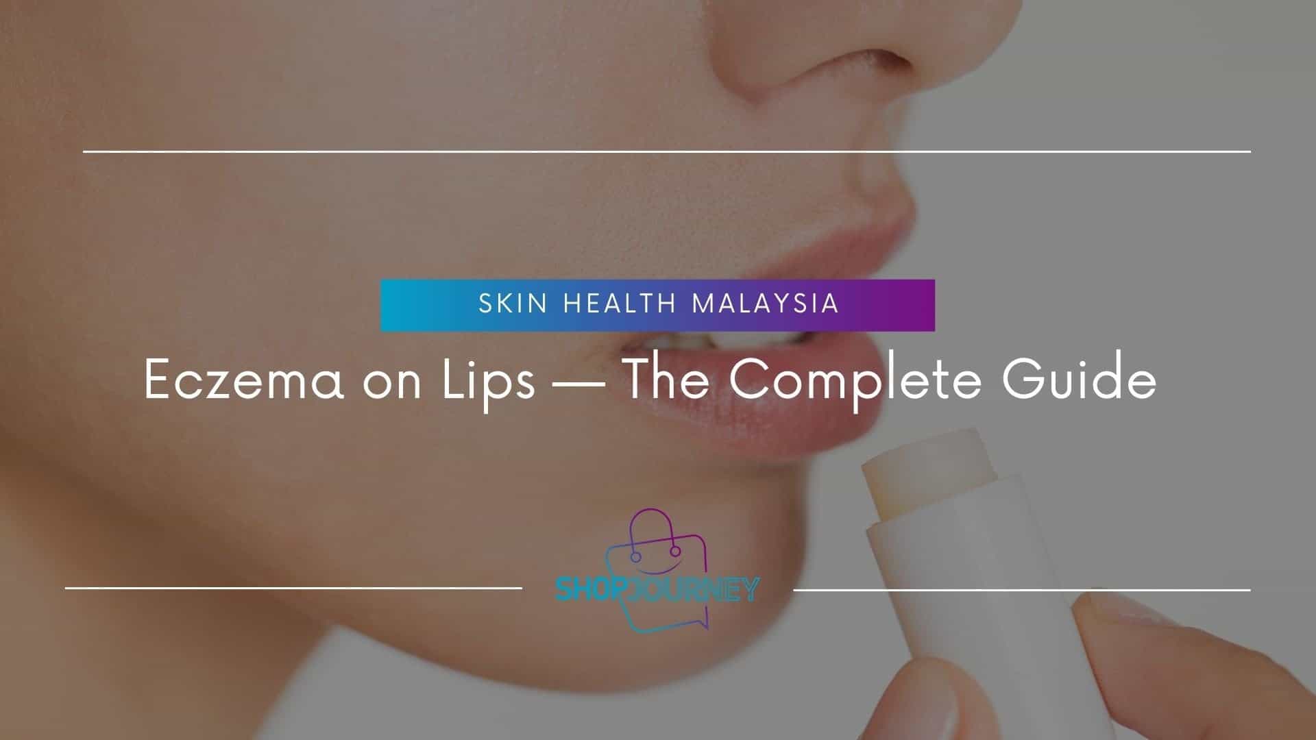 Eczema on Lips - Shop Journey